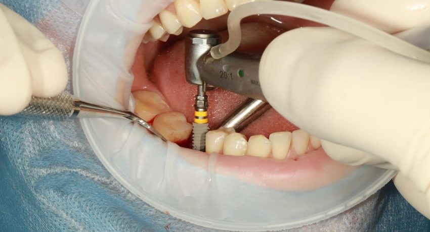 volodymyr007-dental-3754769_1280 (2) (1)